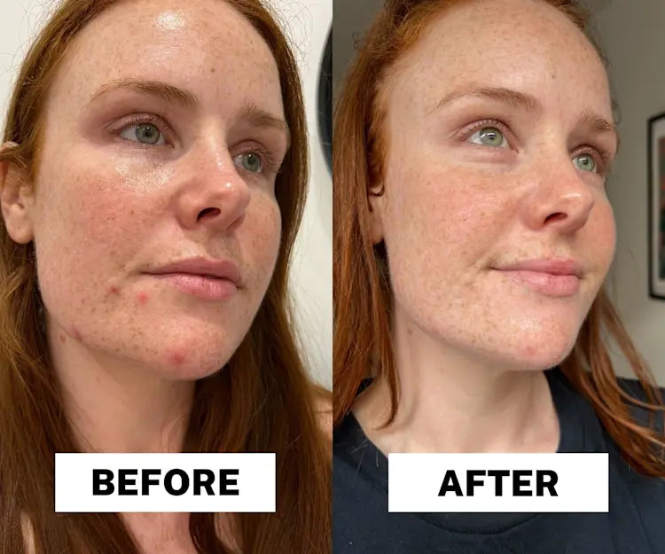 Radiant Glow Duo Peeling Kit