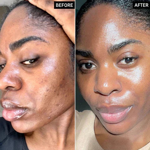 Radiant Glow Duo Peeling Kit
