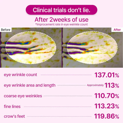Cemenrete Calcium Volume Eye patch 60ea