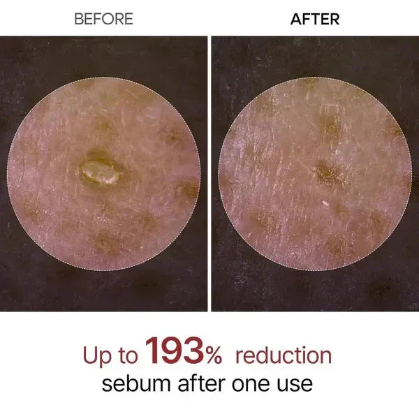 Dr. Melaxin Rice Peel Ampoule
