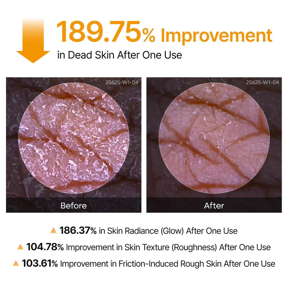 Glass Skin Renewal Kit (6 pcs)